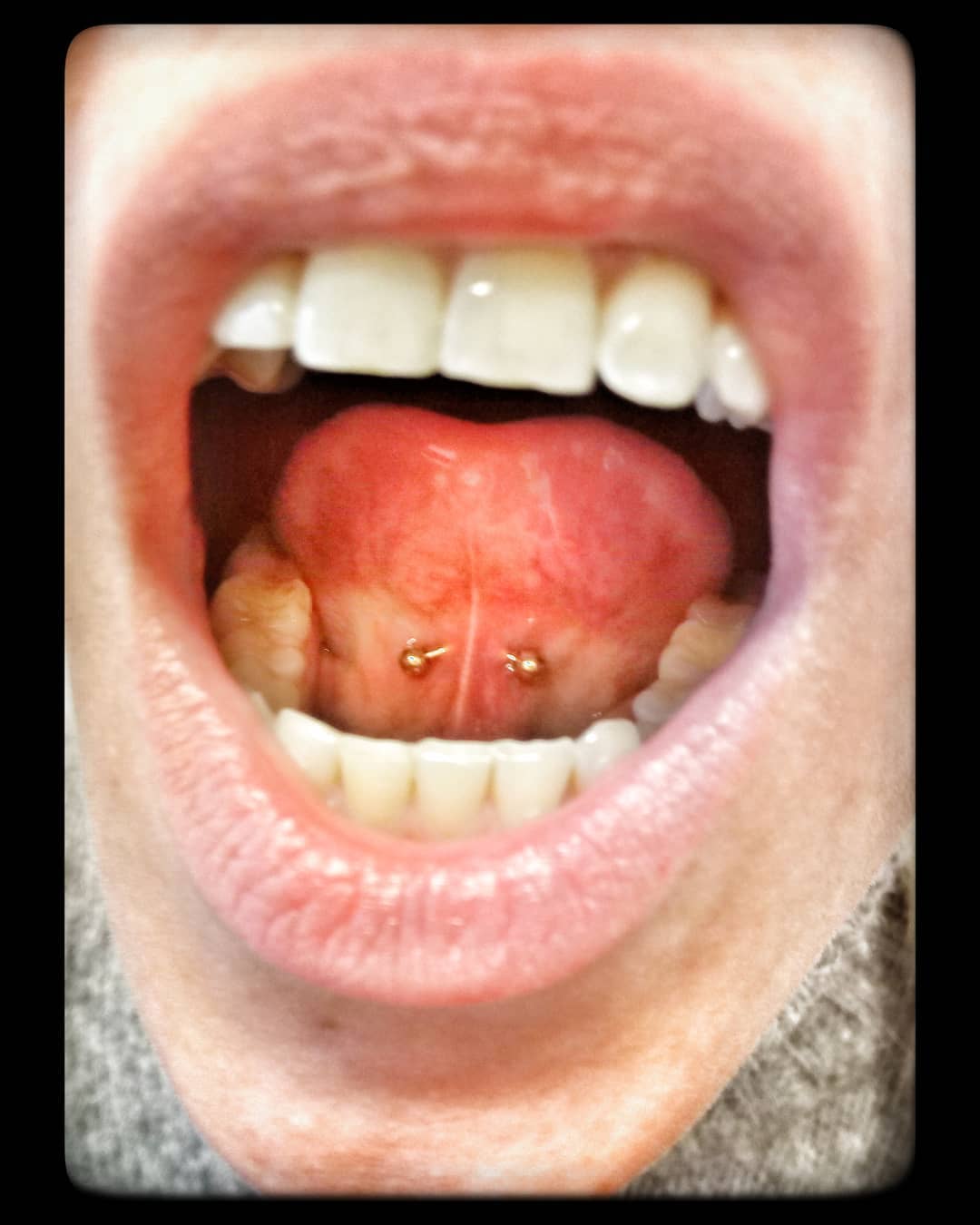 Arany Frenulum piercing