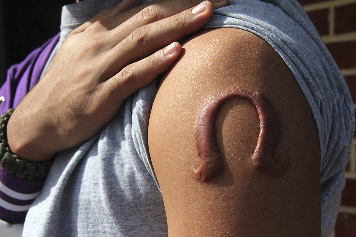 body-mods-scaridication