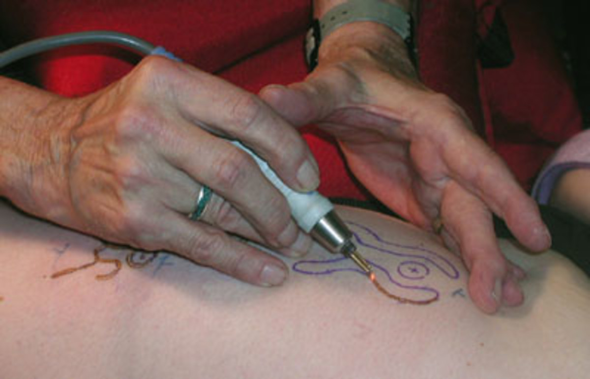 body-mods-scaridication