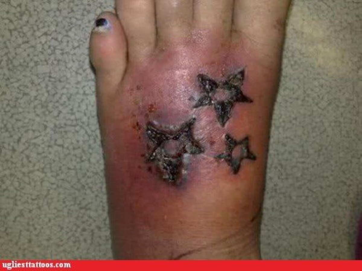 Tartunnan saanut ja turvonnut tatuointi jalalla