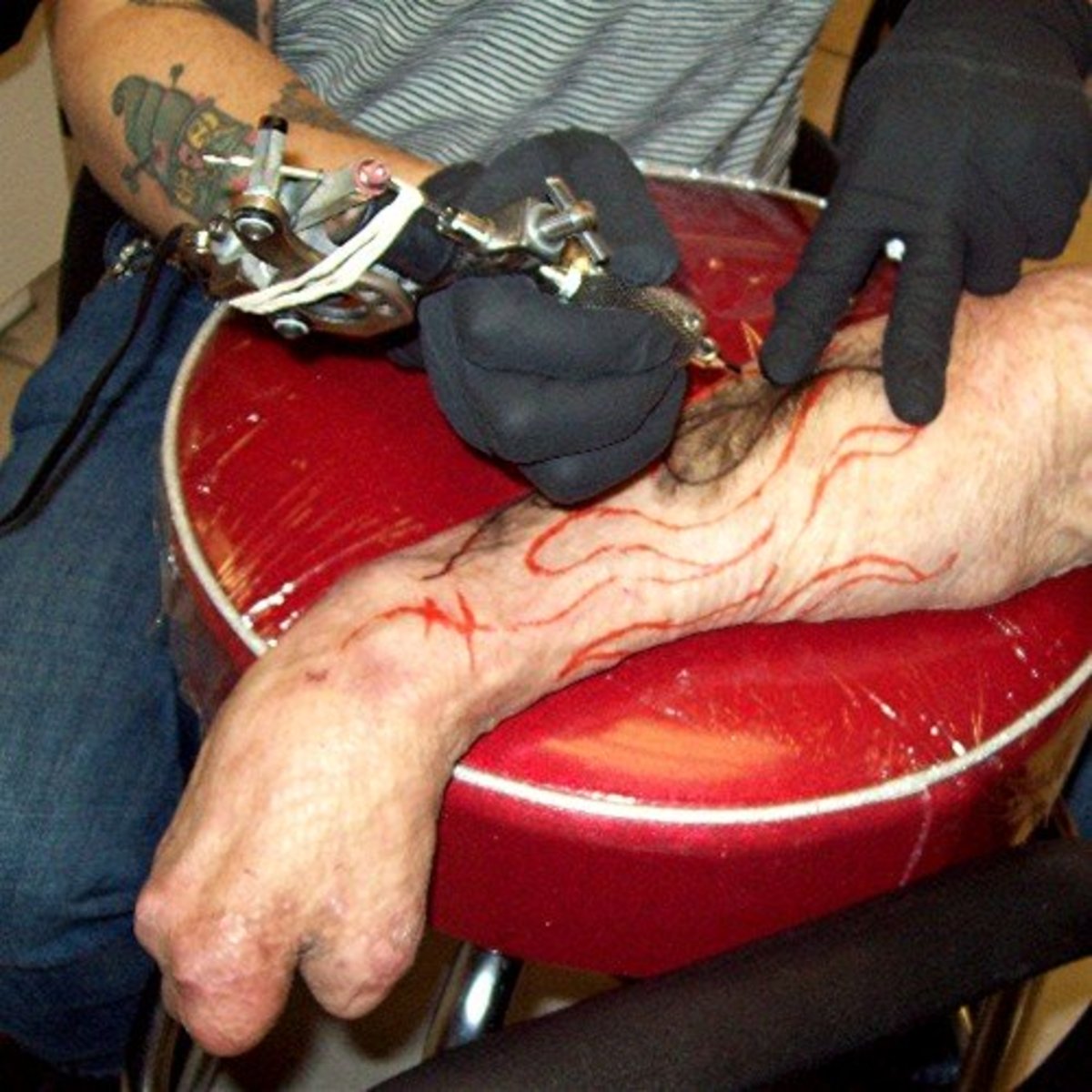 tetoválás-égési hegek