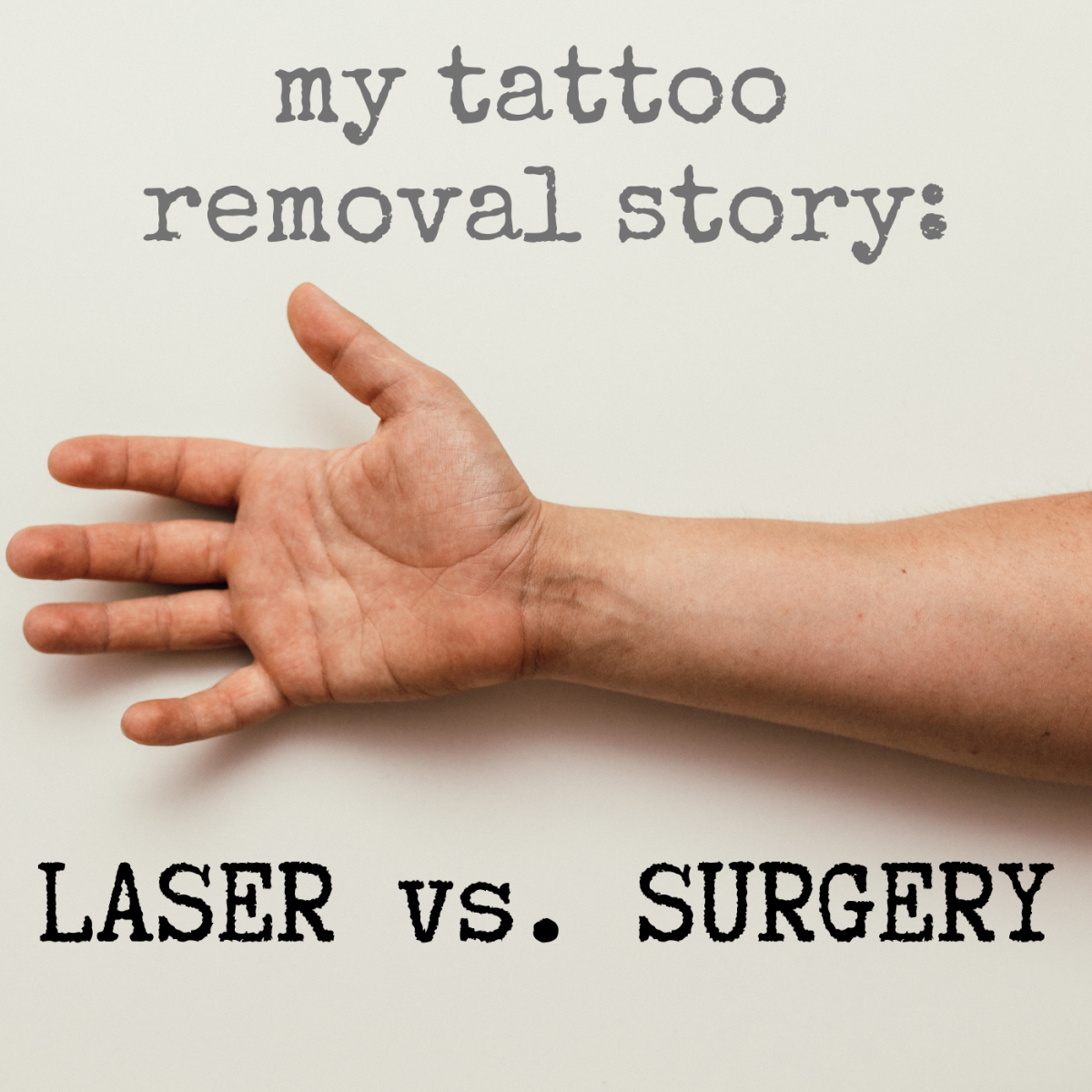 Vyzkoušel jsem odstranění tetování laserem i chirurgickou excizí: Zde je můj příběh (s fotografiemi).